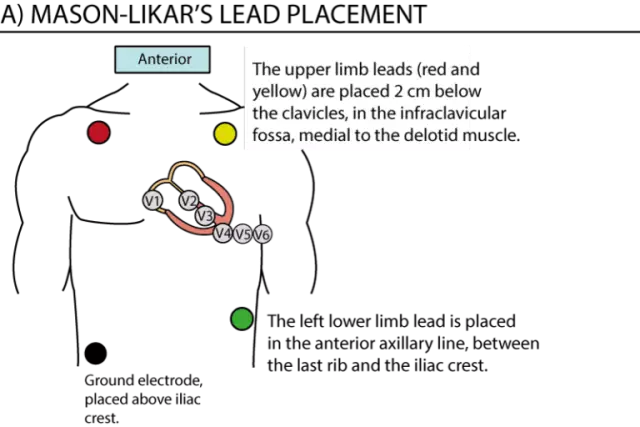 Neuromidin preparation. Analogues, indications, contraindications