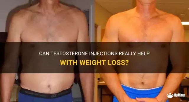 Do injections help to lose weight?