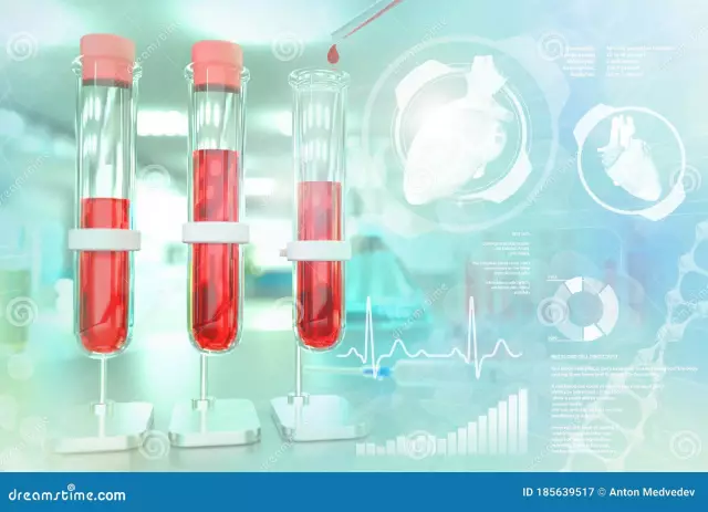 Residual nitrogen in blood biochemistry