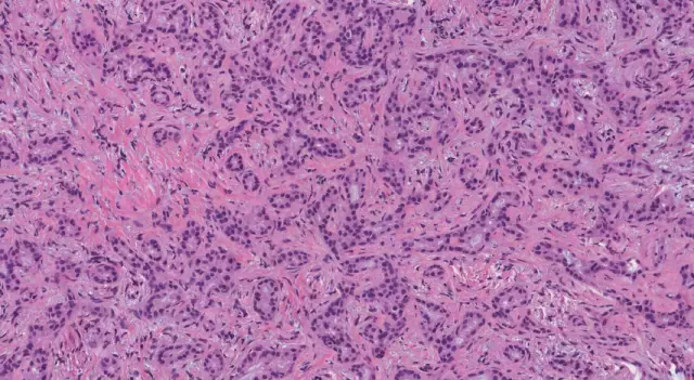 Bile: samenstelling en eigenschappen. De chemische samenstelling van gal