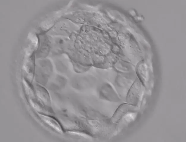 Blastocyst transfer in IVF. Feelings of successful blastocyst transfer