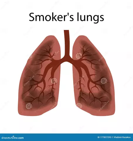 Smoker's lungs are the most vulnerable organ