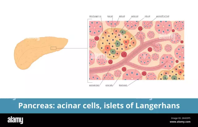 Islet of Langerhans of the pancreas. Antistoffer mot celler på holmene i Langerhans