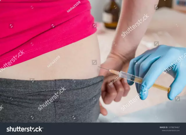 How to give an injection in the buttock?