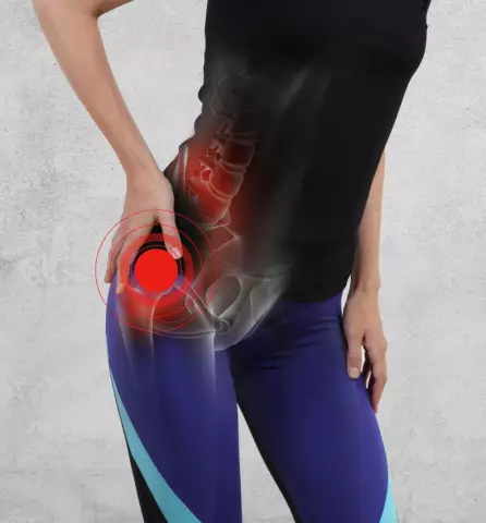 Basic hip injuries