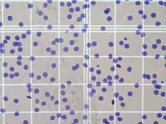 What is Goryaev's cell? Rules for counting blood cells