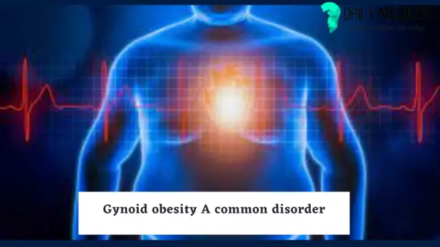 Gynoid lipodystrophy: causes, treatment