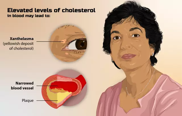 How to lower blood cholesterol: tips and tricks