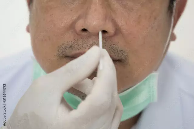 A swab from the pharynx or nose. Procedure and types of laboratory tests