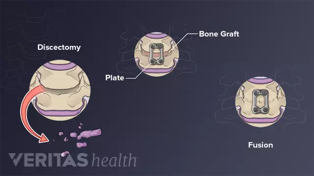 Spine ultrasound: advantages and disadvantages of the method