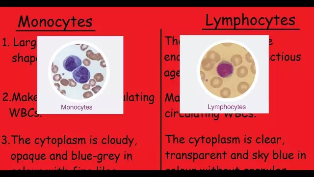 Elevated blood lymphocytes in children: what you need to know