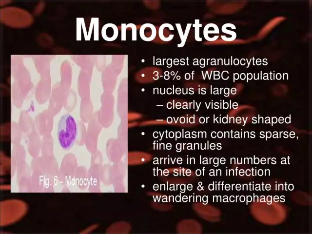 Elevated monocytes - an alarm signal