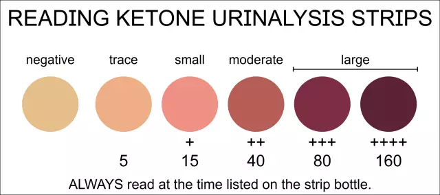 Ketones in urine - causes. Ketones in urine during pregnancy