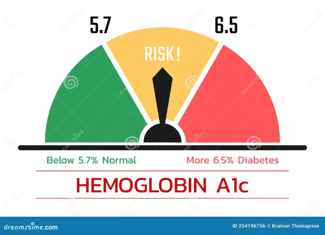 Glykoitunut hemoglobiini on pakollinen testi diabetes mellituksen diagnosoimiseksi ja sen korvaustason arvioimiseksi