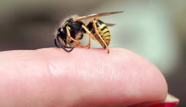 Are wasp stings dangerous? There's an answer