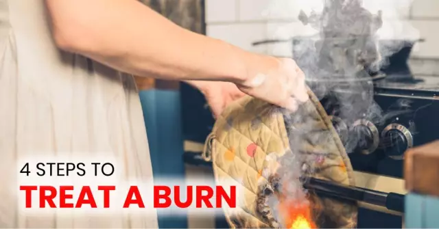 First aid: how to treat a burn?