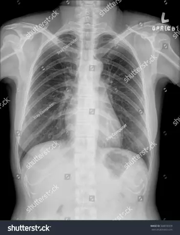 How do bronchoscopy of the lungs and bronchi: reviews. Does a bronchoscopy hurt?