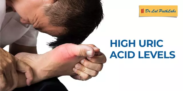 You want to know how to remove uric acid from the body