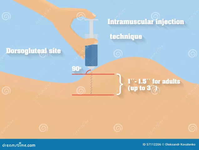 Injecció intramuscular: algorisme. Tècnica d'injecció intramuscular