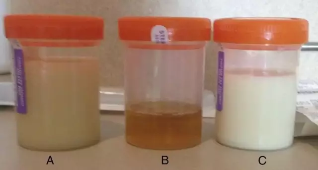 Sugar analysis: preparation, interpretation of results