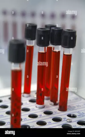 What is ESR in a blood test? What does the deviation from the norm indicate?