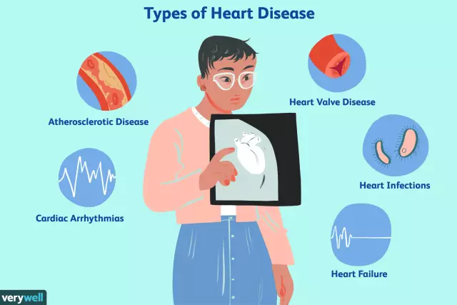 Cerebrovascular disease and its main symptoms