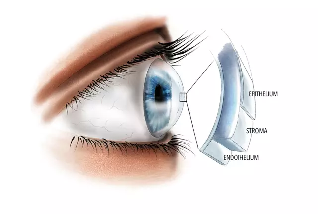 Structure, functions of the cornea