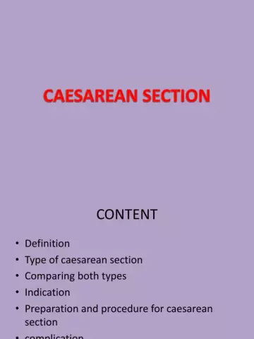 When is a planned caesarean section done?